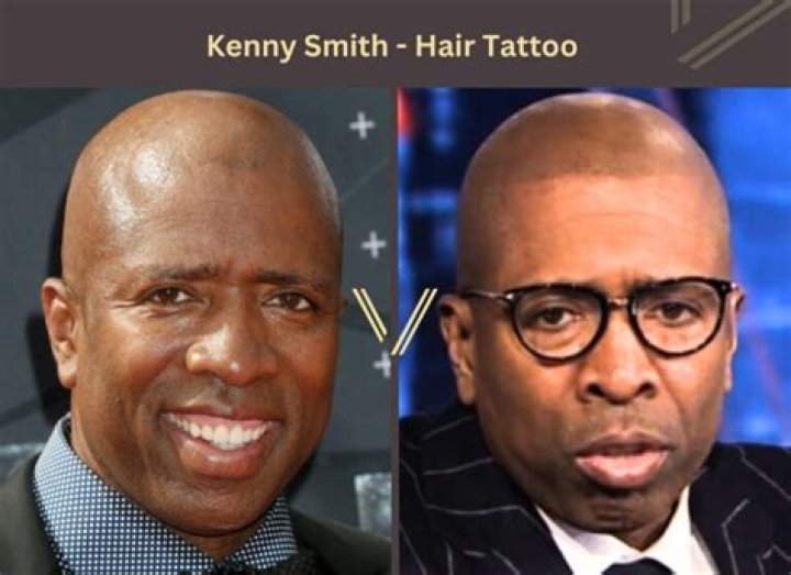 Kenny Smith Hair Loss and Surgery Rumors, Did The Commentator Undergo Transplant?