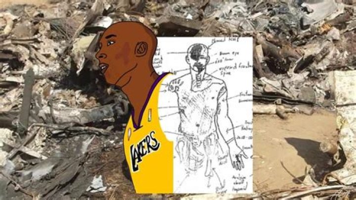 
This Is Why Kobe Bryant Autopsy Sketch Should Not Have Been On Reddit 